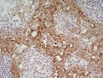 Anti-Marco antibody [ED31] used in IHC (Frozen sections) (IHC-Fr). GTX39744