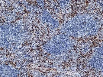 Anti-Ly-6B.2 antibody [7/4] used in IHC (Frozen sections) (IHC-Fr). GTX39793