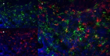 Anti-Ly-6B.2 antibody [7/4] used in IHC (Frozen sections) (IHC-Fr). GTX39794
