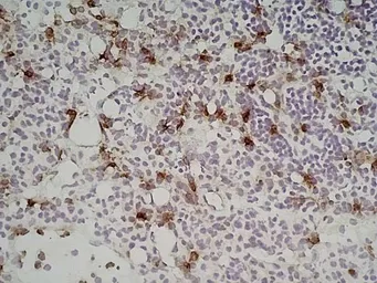 Anti-Ly-6B.2 antibody [7/4] used in IHC (Frozen sections) (IHC-Fr). GTX39794