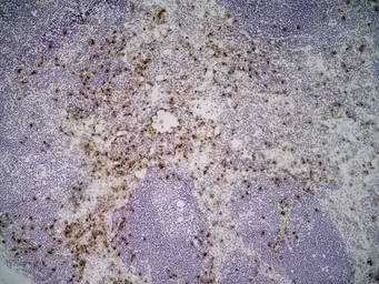 Anti-Ly-6B.2 antibody [7/4] (Low endotoxin, azide free) used in IHC (Frozen sections) (IHC-Fr). GTX39796