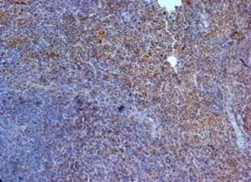 Anti-IL23 Receptor antibody, N-term used in IHC (Paraffin sections) (IHC-P). GTX39947