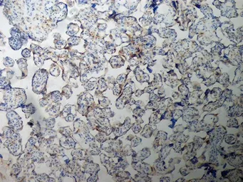 Anti-Inhibin alpha antibody [R1] used in IHC (Frozen sections) (IHC-Fr). GTX40215