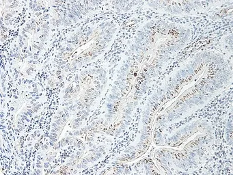 Anti-CXCL2 / GRO beta antibody used in IHC (Paraffin sections) (IHC-P). GTX40895