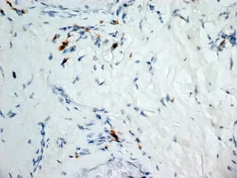 Anti-Dectin-1 antibody [2A11] (Low endotoxin, azide free) used in IHC (Frozen sections) (IHC-Fr). GTX41471