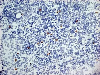 Anti-Dectin-1 antibody [2A11] (Low endotoxin, azide free) used in IHC (Frozen sections) (IHC-Fr). GTX41471