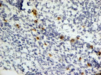 Anti-Dectin-1 antibody [2A11] used in IHC (Frozen sections) (IHC-Fr). GTX41473