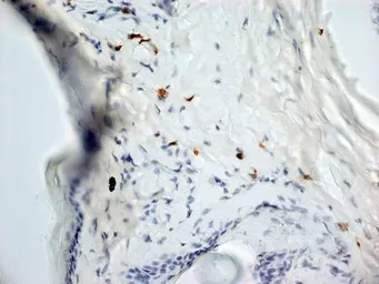 Anti-Dectin-1 antibody [2A11] used in IHC (Frozen sections) (IHC-Fr). GTX41473