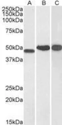 Anti-NDRG1 antibody, C-term used in Western Blot (WB). GTX41727
