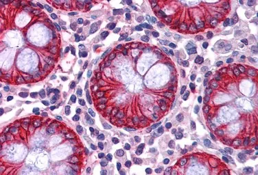 Anti-NDRG1 antibody, C-term used in IHC (Paraffin sections) (IHC-P). GTX41727