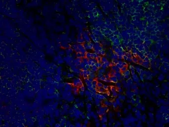 Anti-CD8 alpha antibody [OX-8] used in IHC (Frozen sections) (IHC-Fr). GTX41830