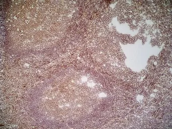 Anti-CD70 antibody [Bu69] used in IHC (Frozen sections) (IHC-Fr). GTX41859