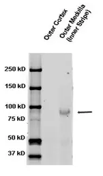 Anti-ENaC Beta antibody used in Western Blot (WB). GTX41971