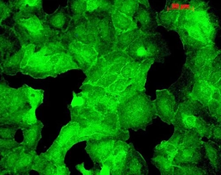 Anti-PSD95 antibody [6G6] used in Immunocytochemistry/ Immunofluorescence (ICC/IF). GTX41974
