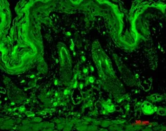 Anti-PSD95 antibody [7E3] used in Immunocytochemistry/ Immunofluorescence (ICC/IF). GTX41975