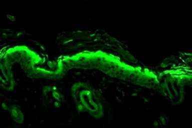 Anti-Nitrotyrosine antibody [39B6] used in IHC (Paraffin sections) (IHC-P). GTX41979