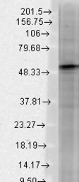 Anti-GABA A Receptor beta 3 antibody [S87-25] used in Western Blot (WB). GTX42018
