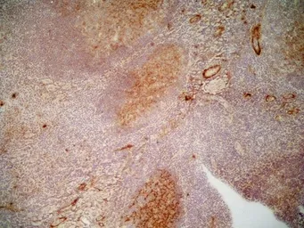 Anti-CD36 antibody [SMØ] used in IHC (Frozen sections) (IHC-Fr). GTX42050