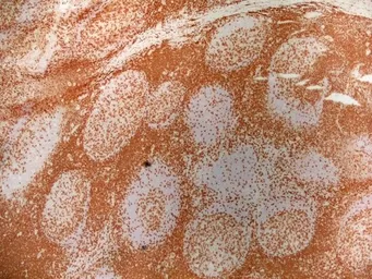 Anti-CD3 epsilon antibody [UCHT1] (Low endotoxin, azide free) used in IHC (Frozen sections) (IHC-Fr). GTX42102