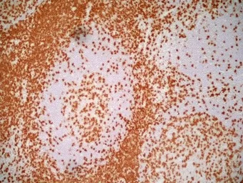 Anti-CD3 epsilon antibody [UCHT1] (Low endotoxin, azide free) used in IHC (Frozen sections) (IHC-Fr). GTX42102