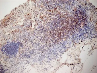 Anti-CD3 antibody [KT3] used in IHC (Frozen sections) (IHC-Fr). GTX42104