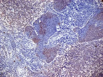 Anti-CD3 antibody [KT3] used in IHC (Frozen sections) (IHC-Fr). GTX42104
