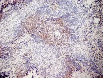 Anti-CD3 antibody [KT3] used in IHC (Frozen sections) (IHC-Fr). GTX42104