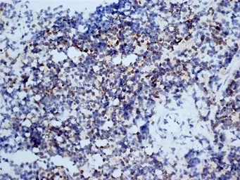 Anti-CD3 antibody [KT3] used in IHC (Frozen sections) (IHC-Fr). GTX42105
