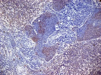 Anti-CD3 antibody [KT3] used in IHC (Frozen sections) (IHC-Fr). GTX42106