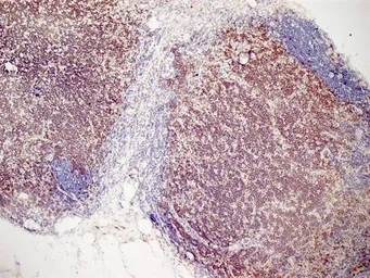 Anti-CD3 antibody [KT3] (Low endotoxin, azide free) used in IHC (Frozen sections) (IHC-Fr). GTX42108