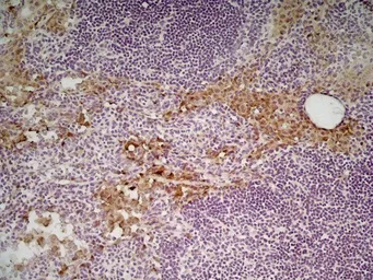 Anti-Mannose Receptor antibody [MR5D3] used in IHC (Frozen sections) (IHC-Fr). GTX42265