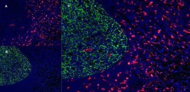 Anti-CD163 antibody [EDHu-1] used in IHC (Frozen sections) (IHC-Fr). GTX42365