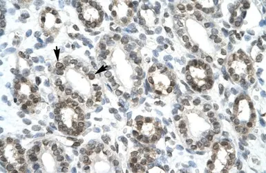 Anti-HEY1 antibody, C-term used in IHC (Paraffin sections) (IHC-P). GTX42614