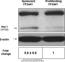 Anti-HEY1 antibody, C-term used in Western Blot (WB). GTX42614