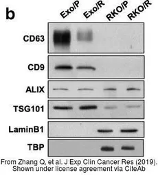 Anti-ALIX antibody [3A9] used in Western Blot (WB). GTX42812
