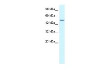 Anti-CREB3L2 antibody, N-term used in Western Blot (WB). GTX44627