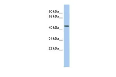 Anti-PDCD7 antibody, N-term used in Western Blot (WB). GTX44815