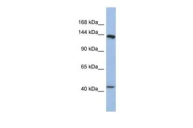 Anti-SLIT1 antibody, Internal used in Western Blot (WB). GTX44819