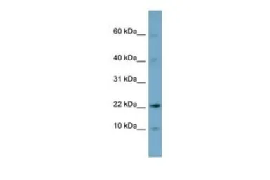 Anti-DPPA5 antibody, N-term used in Western Blot (WB). GTX44822