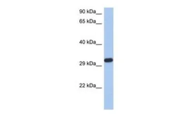 Anti-CAPZA3 antibody, N-term used in Western Blot (WB). GTX44837