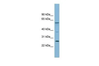 Anti-GDAP2 antibody, N-term used in Western Blot (WB). GTX44991