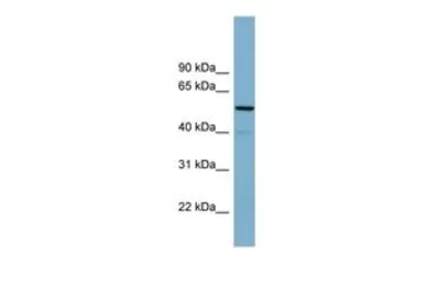 Anti-CDK5RAP1 antibody, N-term used in Western Blot (WB). GTX45006