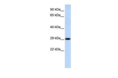 Anti-HSD17B14 antibody, Internal used in Western Blot (WB). GTX45014