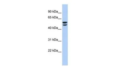 Anti-ATP6V1B2 antibody, N-term used in Western Blot (WB). GTX45066