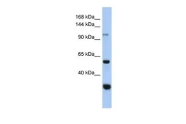 Anti-GANC antibody, Internal used in Western Blot (WB). GTX45176