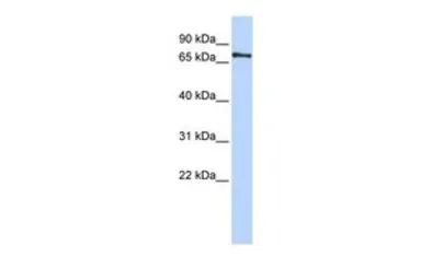 Anti-PHACTR1 antibody, Internal used in Western Blot (WB). GTX45287