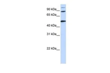 Anti-COG4 antibody, Internal used in Western Blot (WB). GTX45311