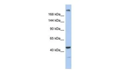 Anti-KIAA0284 antibody, N-term used in Western Blot (WB). GTX45328