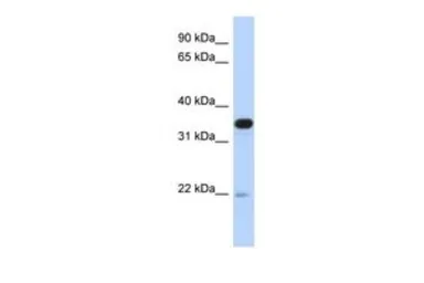 Anti-PITPNB antibody, Internal used in Western Blot (WB). GTX45365