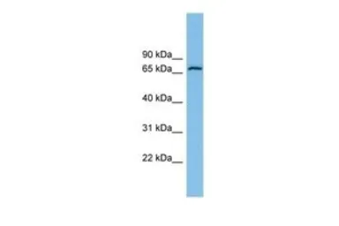 Anti-GLUD2 antibody, N-term used in Western Blot (WB). GTX45373